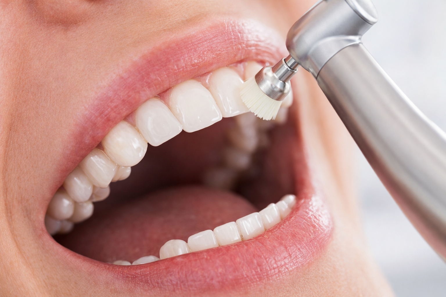 Limpeza e Clareamento